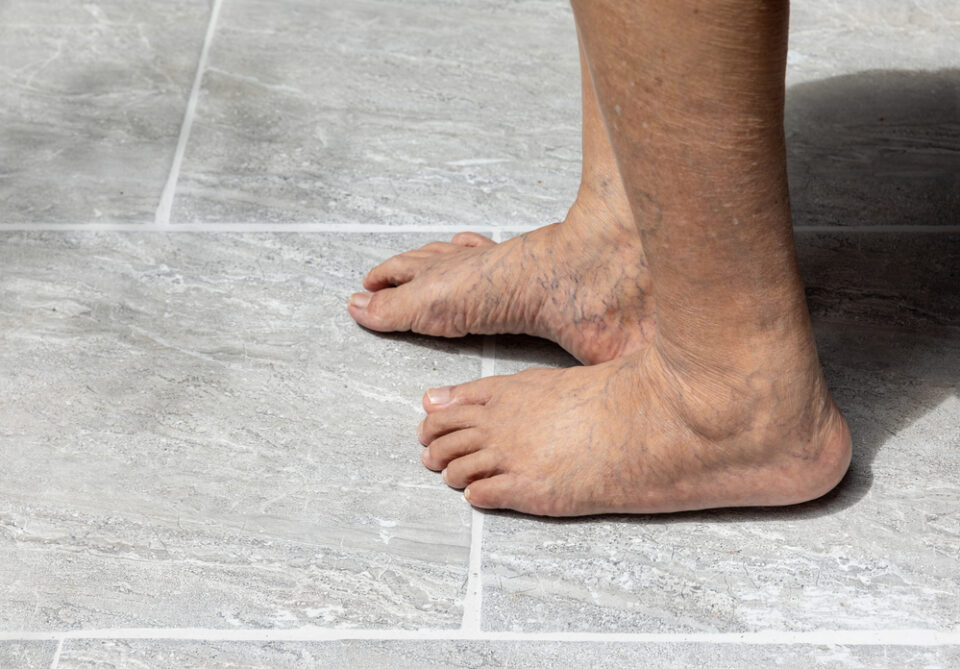 What You Need To Know About Caring For Aging Feet And Keeping Them Healthy