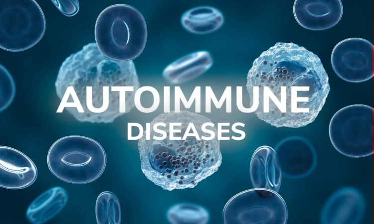 Autoimmune Disease
