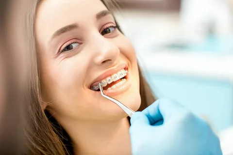 Orthodontic braces
