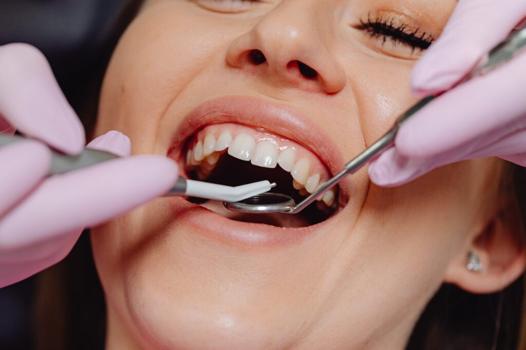 GUMS Procedure