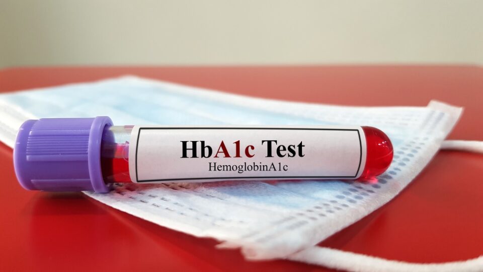 HbA1c test