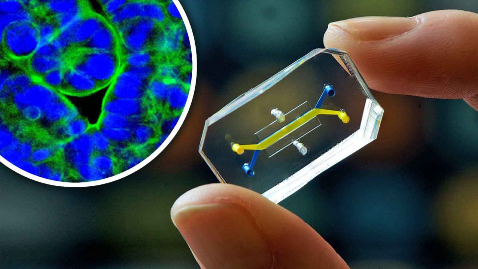 Organ-on-chip Market