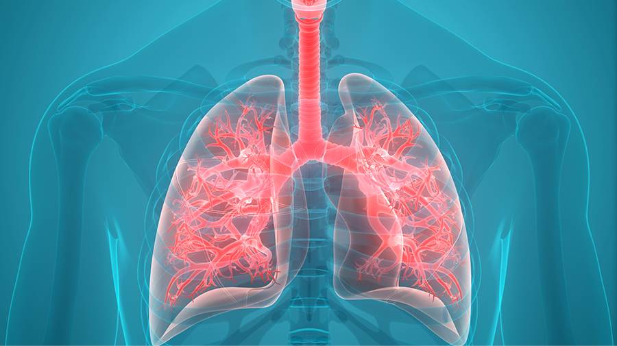 Pneumonia Testing Market