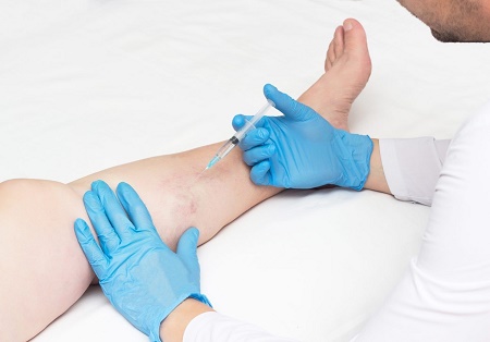 what is a vein doctor called
