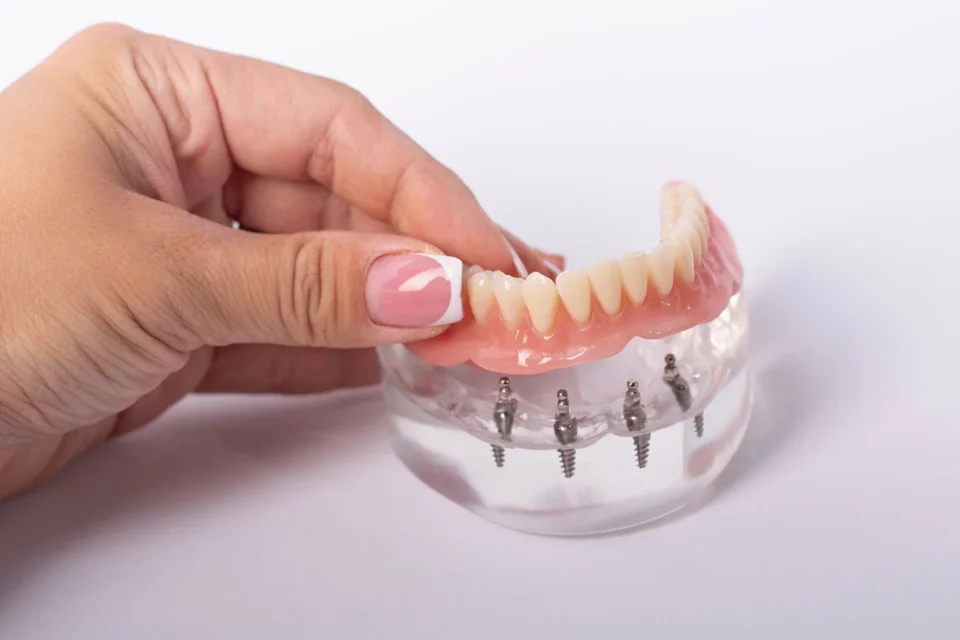 cheap dentures near me