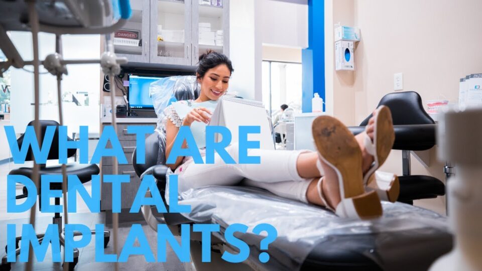 What Are Dental Implants