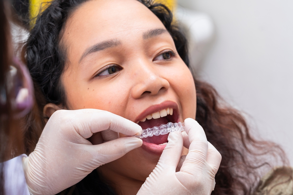 invisalign