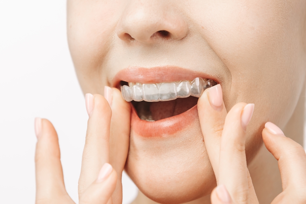 invisalign