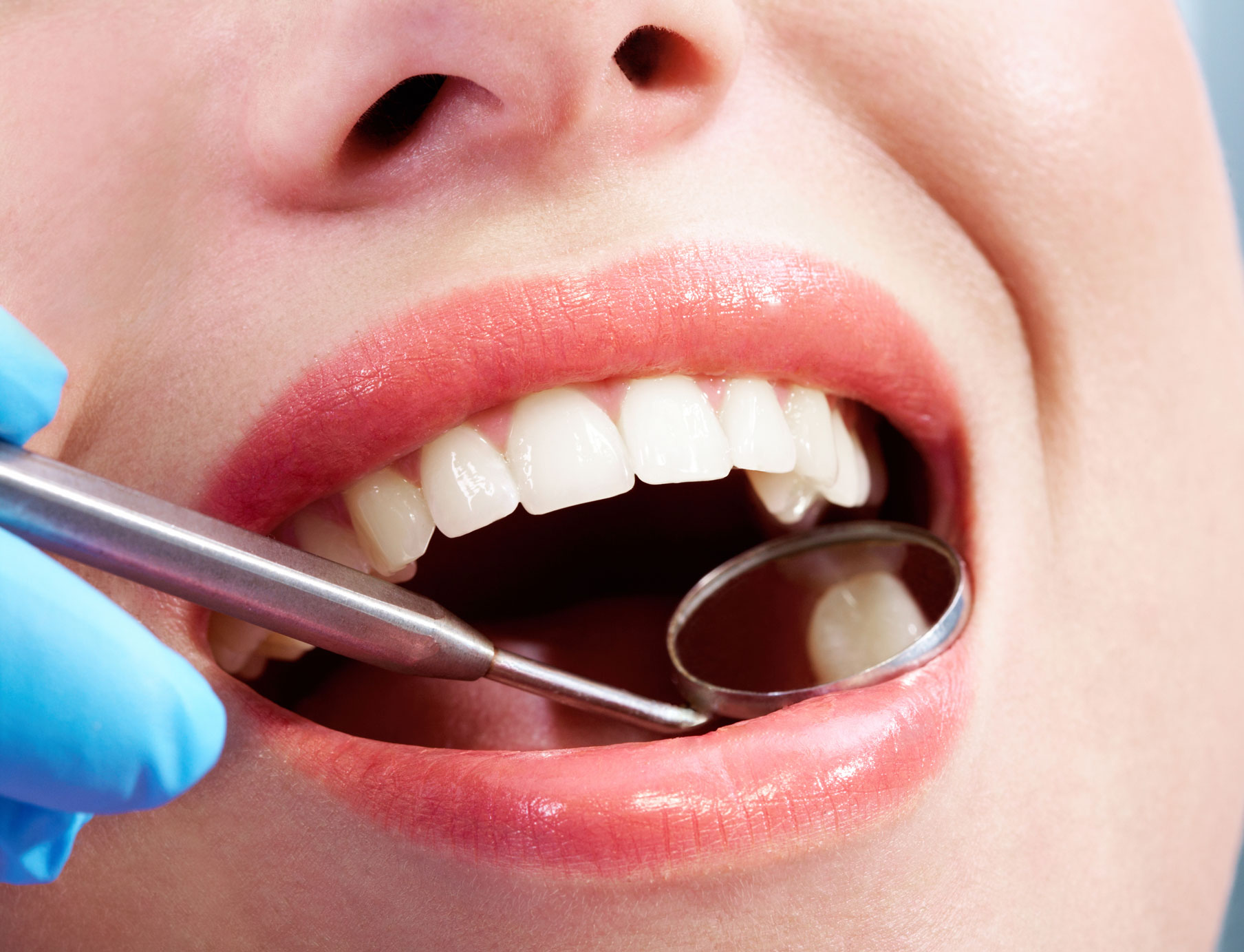 veneers specialist