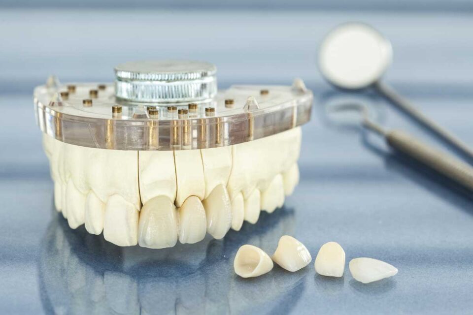 tooth crown near me